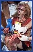 Bloody victim of World Trade  Center attack 
